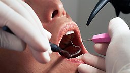 Tandläkare undersöker patient.